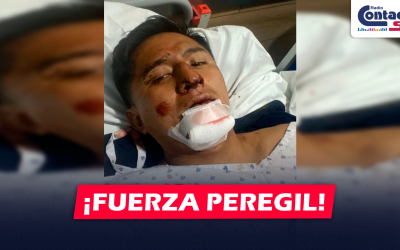 AREQUIPA: TIKTOKER PEREGIL SUFRE FUERTE ACCIDENTE MANEJANDO SU MOTO Y TERMINA CON EL FÉMUR Y LA NARIZ ROTA