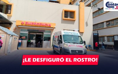 AREQUIPA: JOVEN ESTILISTA Y ATACADA POR SU PAREJA Y EL PRIMO DE ESTE DEJÁNDOLA CON EL ROSTRO DESFIGURADO