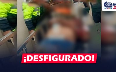 AREQUIPA: HALLAN A VARÓN CON EL ROSTRO DESFIGURADO EN PLENA CALLE EN EL DISTRITO DE PAUCARPATA
