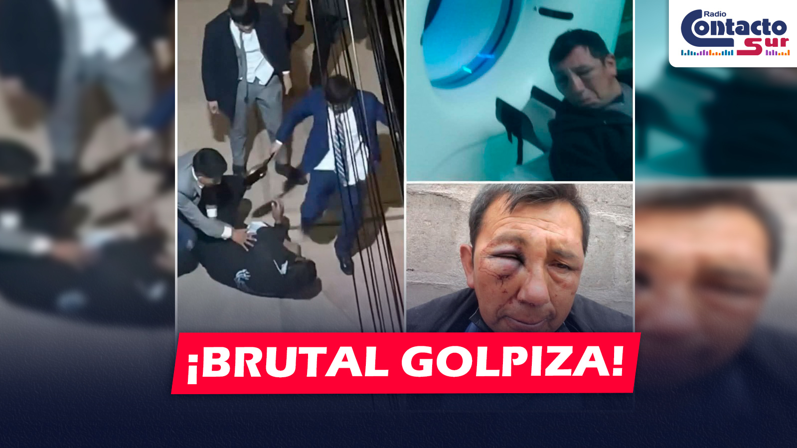 NACIONAL: AGENTE DE SEGURIDAD QUEDA GRAVE TRAS BRUTAL GOLPIZA DE SUJETOS EBRIOS EN LOCAL DE EVENTOS