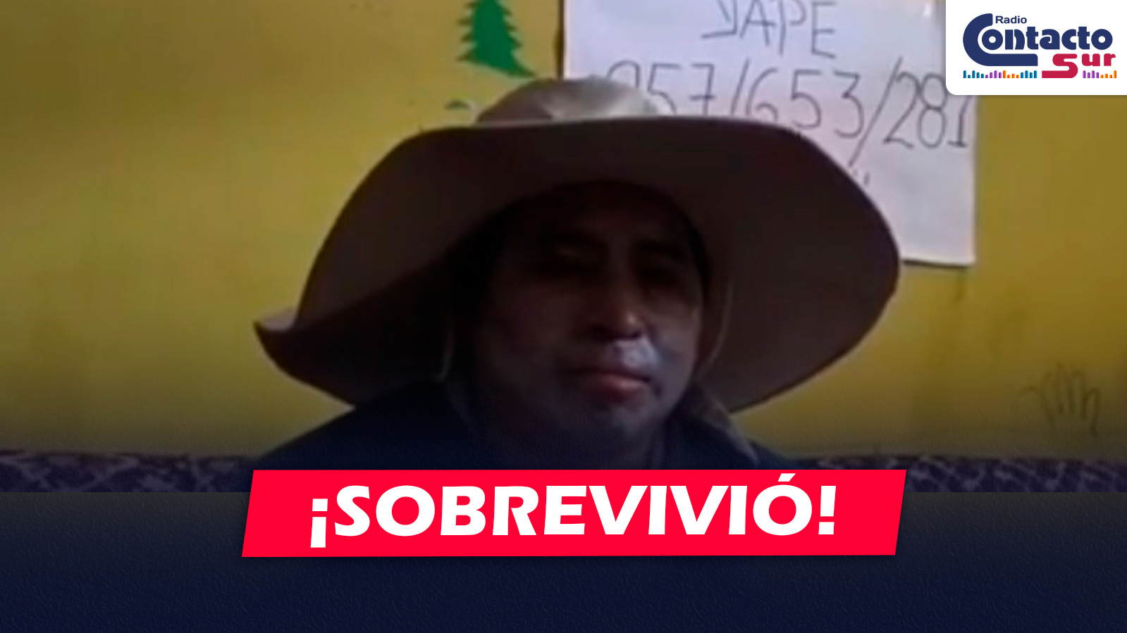 AREQUIPA: CERRAJERO BUSCA RECUPERAR LA MOVILIDAD TRAS SUFRIR GRAVES QUEMADURAS Y REALIZA ACTIVIDAD SOLIDARIA PARA COSTEAR SU REHABILITACIÓN