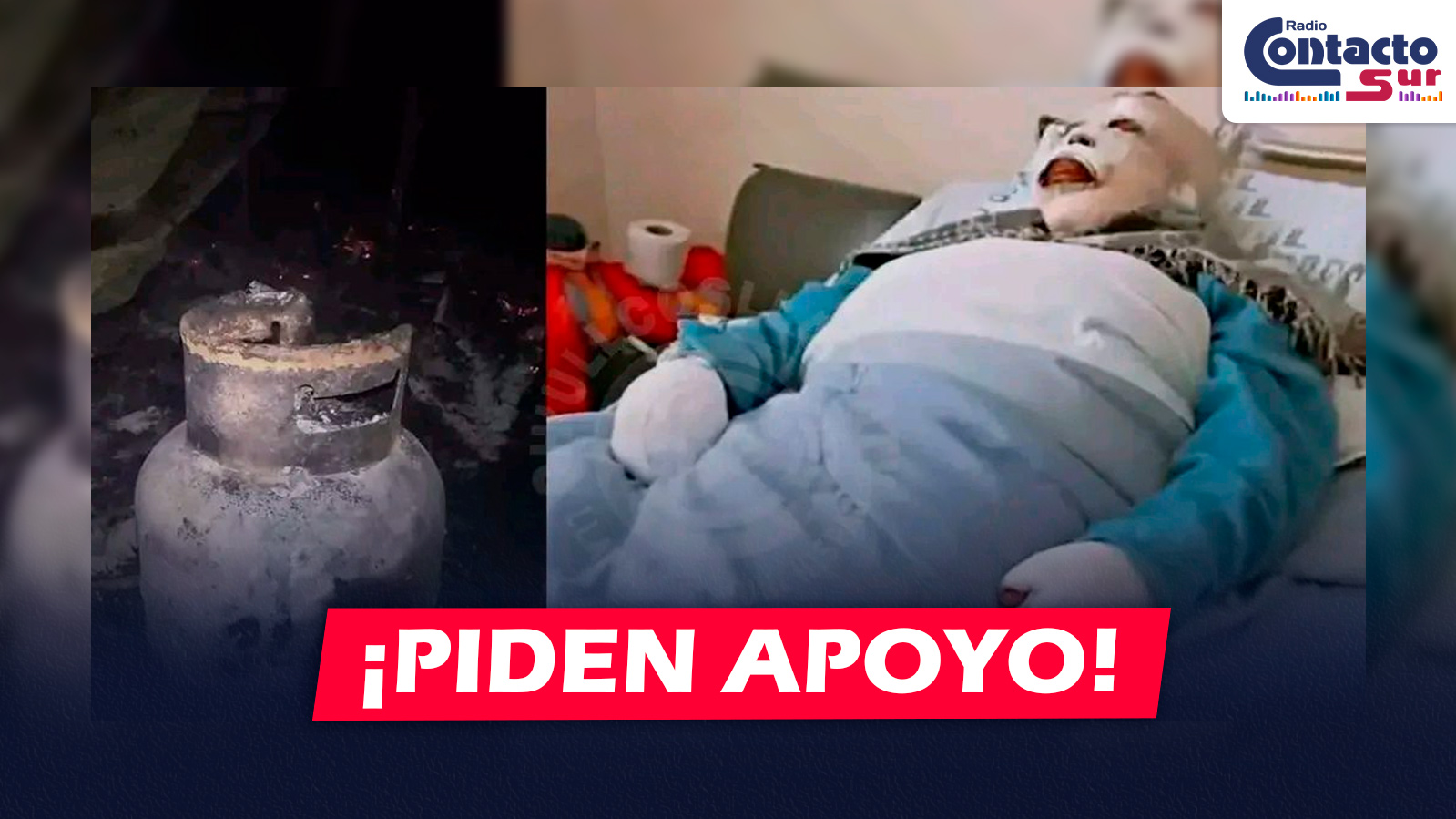 AREQUIPA: EXPLOSIÓN DE BALÓN DE GAS DEJA GRAVE A MADRE DE DOS NIÑOS Y PIDEN APOYO SOLIDARIO