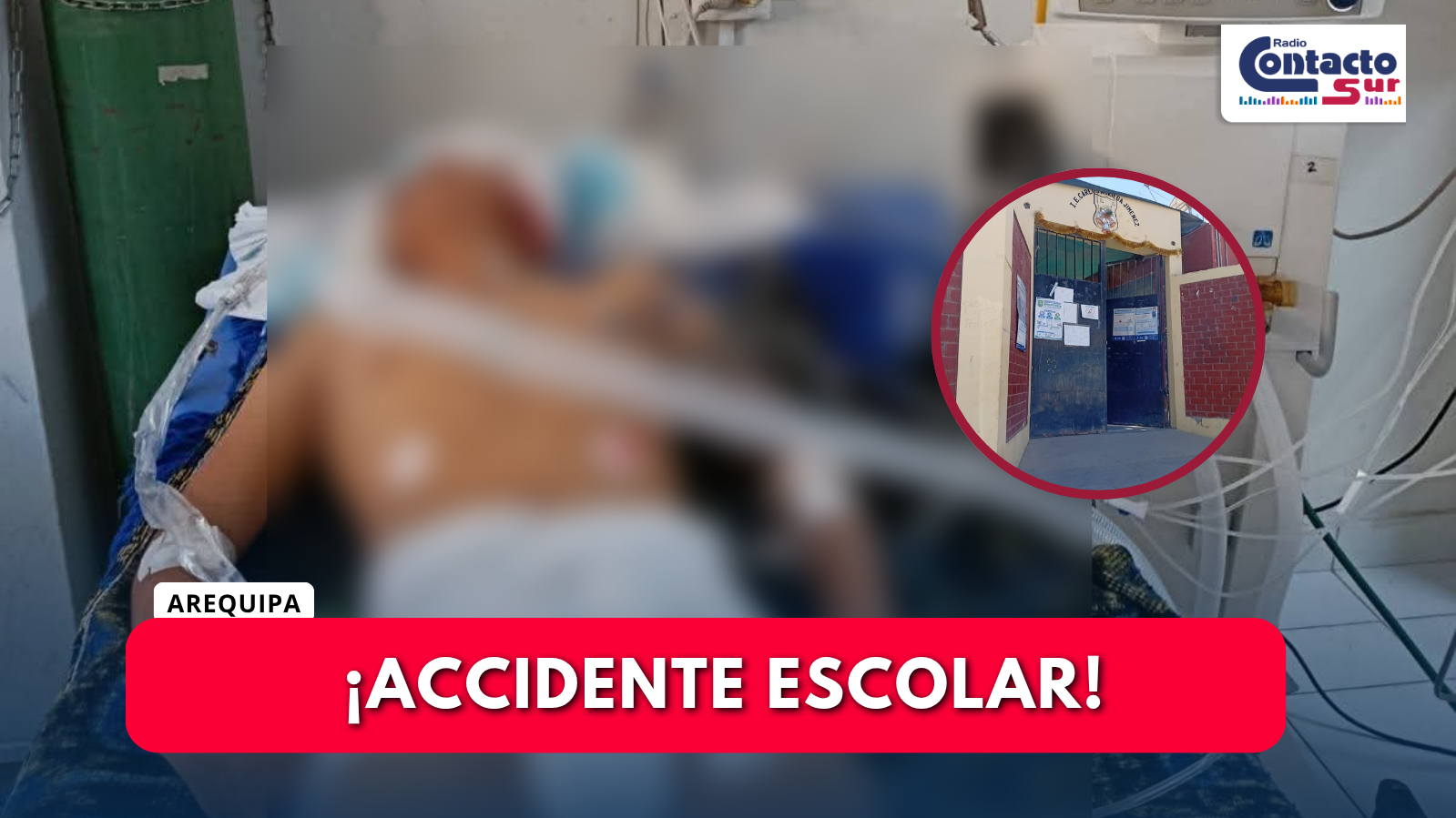 HUANUHUANU: GRAVE ACCIDENTE DEJA A DOS ESCOLARES HERIDOS CUANDO IBAN EN MOTOCICLETA A SU CENTRO DE ESTUDIOS 